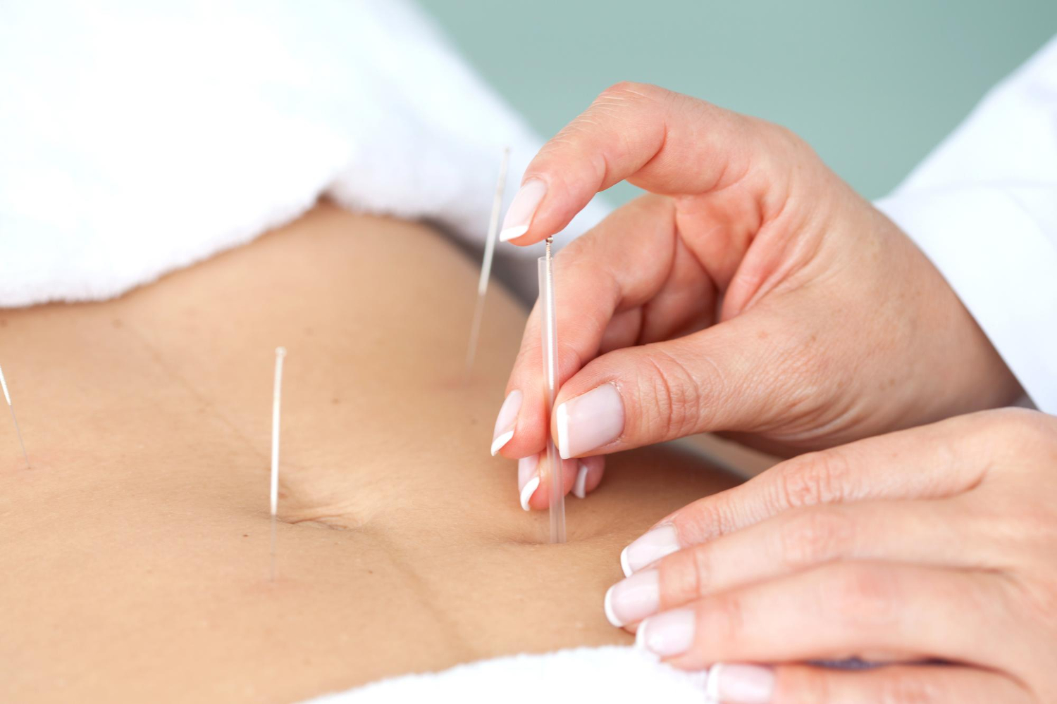 The Complete Guide to Dry Needling